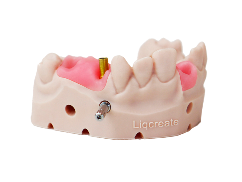 Gums 3D printed with the pink Gingiva Mask resin
